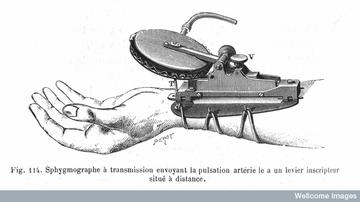 Figure of a sphygmograph, used to chart the pulse