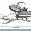 Figure of a sphygmograph, used to chart the pulse